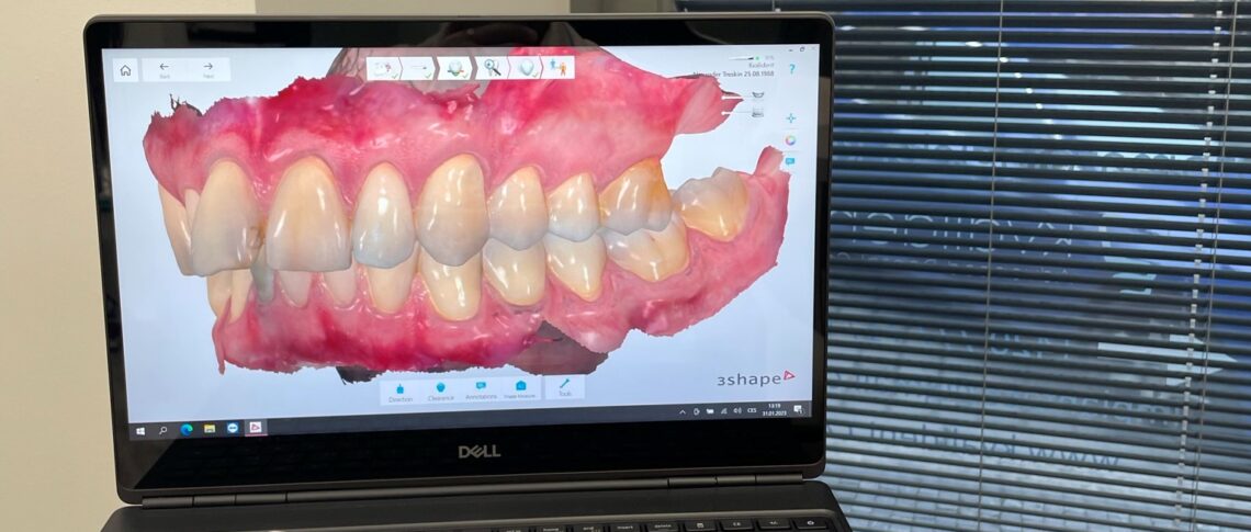 Intraorální skener TRIOS 5