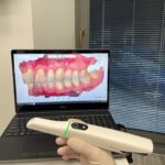 Neuer Intraoralscanner