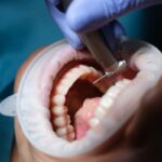 Bolest zubu: příčiny, přízna...